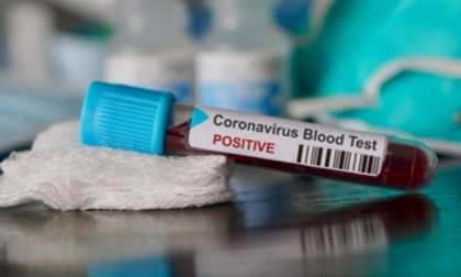 Coronavirus: i contagi in Veneto passano da 511 a 543