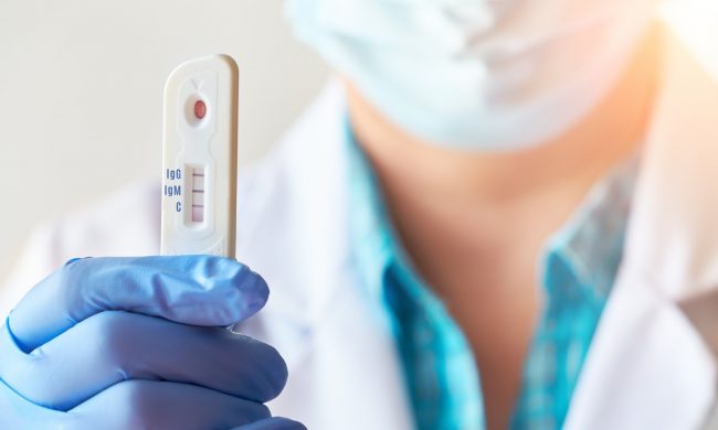 Obbligo tamponi, Zaia precetta anche i veterinari: “L’uomo è un mammifero”