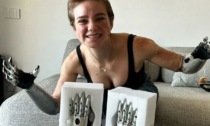 La veneziana Bebe Vio mostra le sue nuove mani bioniche