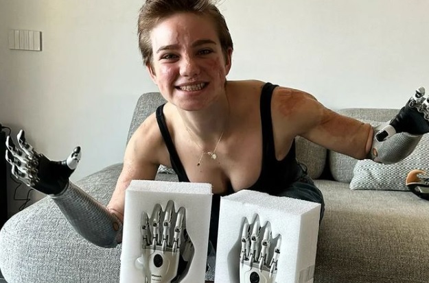 La veneziana Bebe Vio mostra le sue nuove mani bioniche